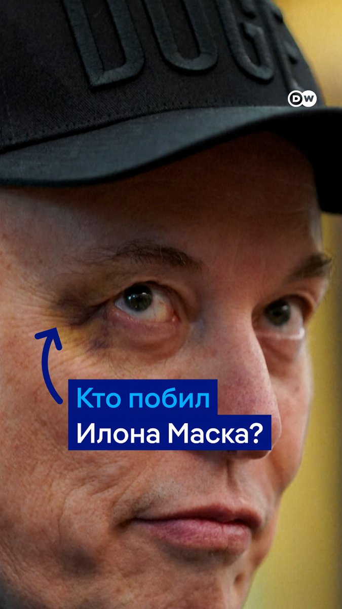 Илон Маск покидает Белый дом с огромным синяком и шутит про семью Макрона. Что случилось?