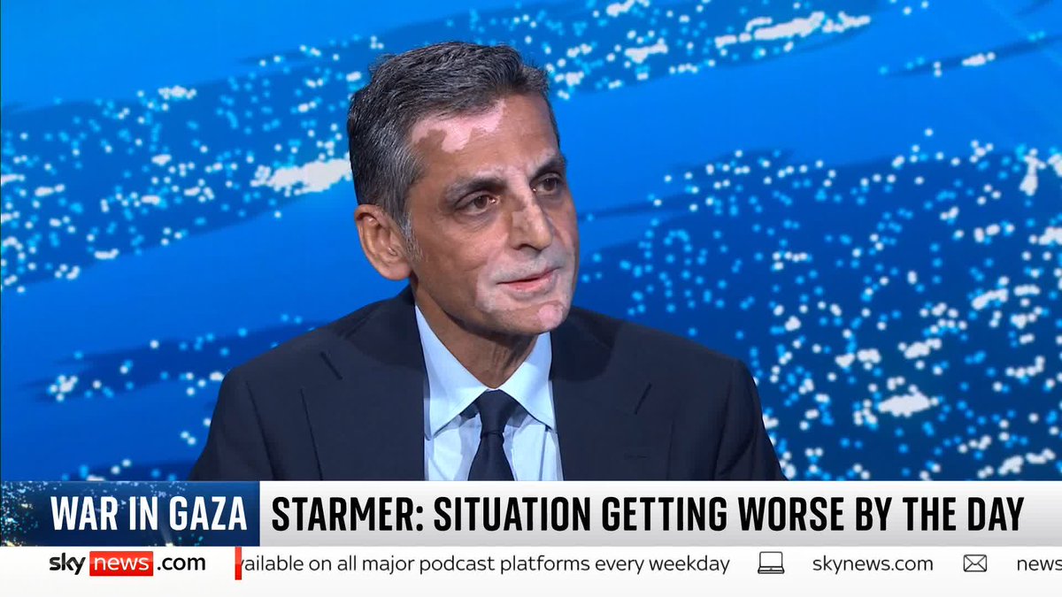 Warning: graphic images Dr Waseem Saeed is a consultant plastic and reconstructive surgeon who has been working in Gaza. He discusses with @skyyaldahakim some of the patients that he's dealt with and what he's witnessed. 📺 Sky 501 and YouTube