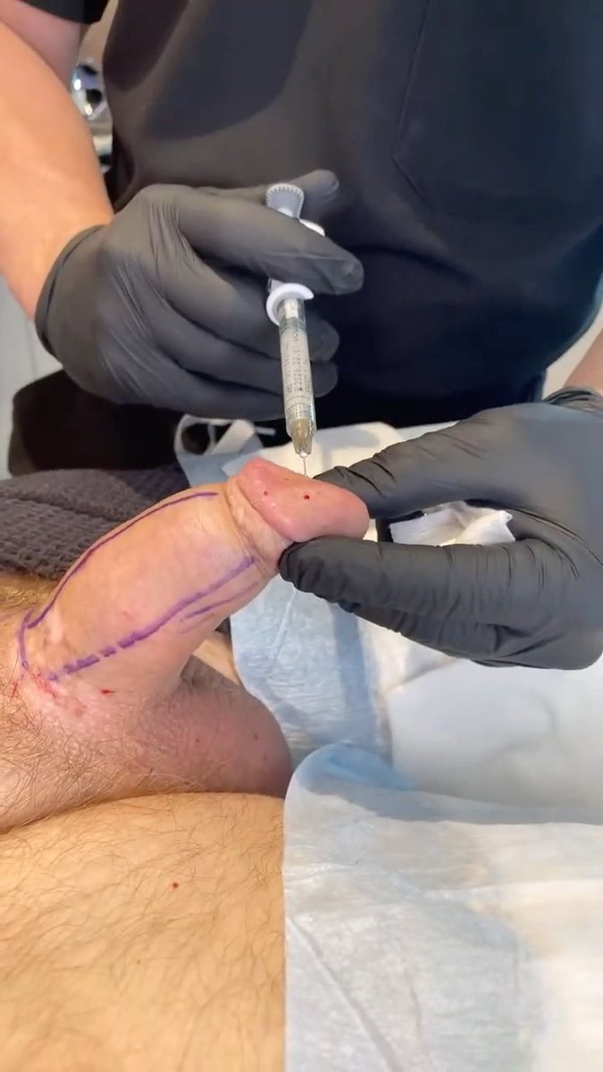 EDUCATION_ LEARN ABOUT PENILE ENHANCEMENT | Dr. Jason Emer