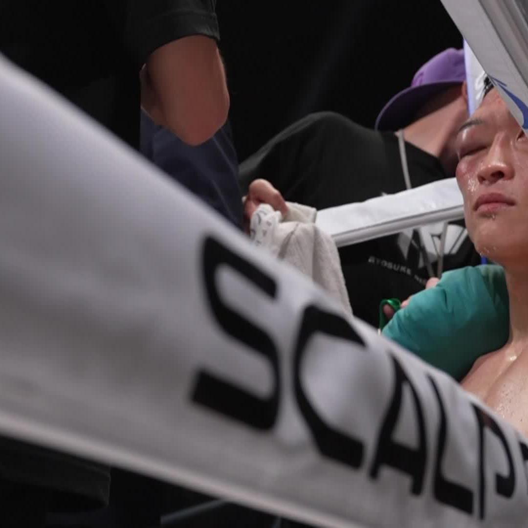 The final look at Nishida's eye. Wow.