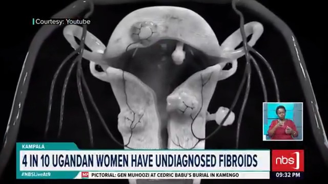 VIDEO: A growing number of Ugandan women are unknowingly living with uterine fibroids, a reproductive health condition that experts say is becoming an urgent concern in the country. Mugenyi Henry #NBSLiveAt9 #NBSUpdates