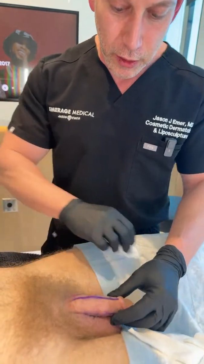 THE FIRST STEP TOWARDS A MASSIVE PENIS Dr. Jason Emer