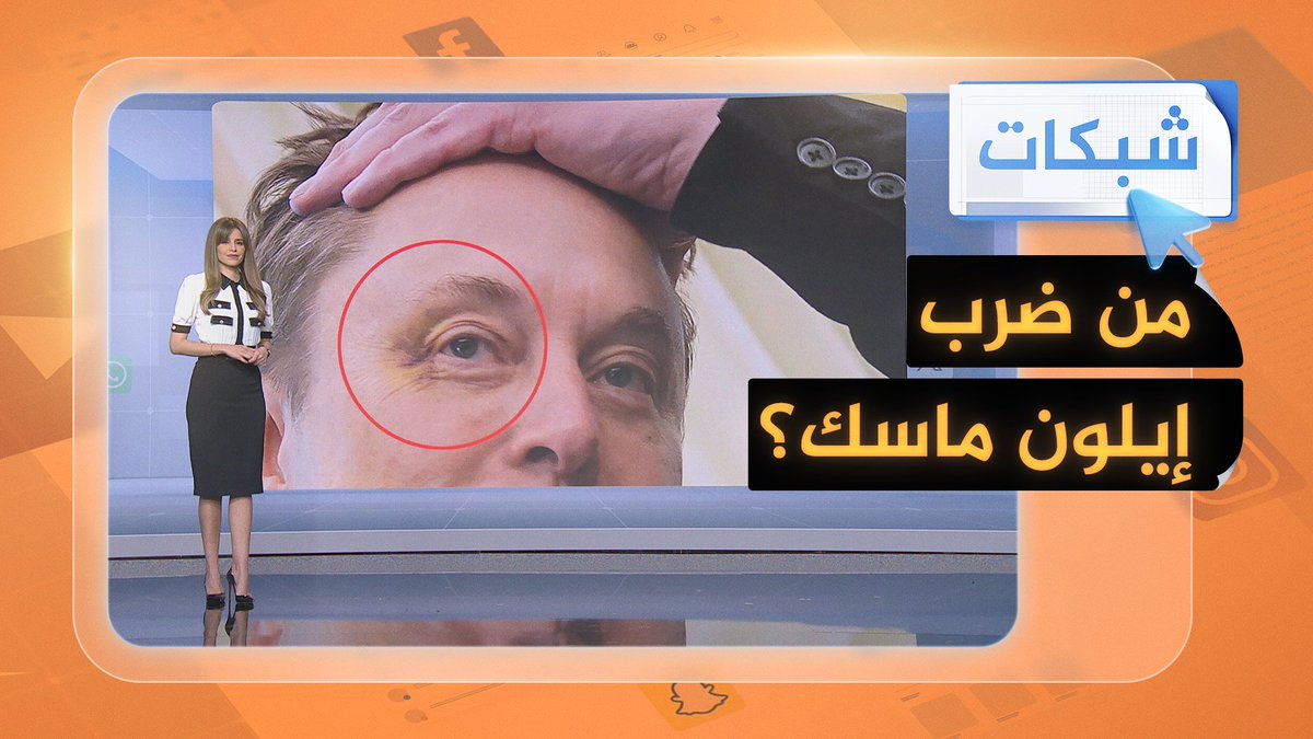 من لكم إيلون ماسك وسبّب له كدمة زرقاء في عينه؟ #شبكات