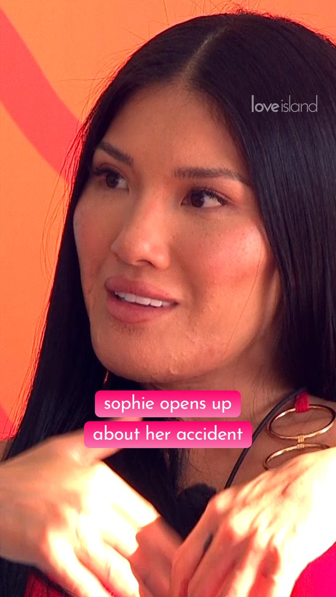 Sophie opens up to Harry about her fire accident 💗 #LoveIsland