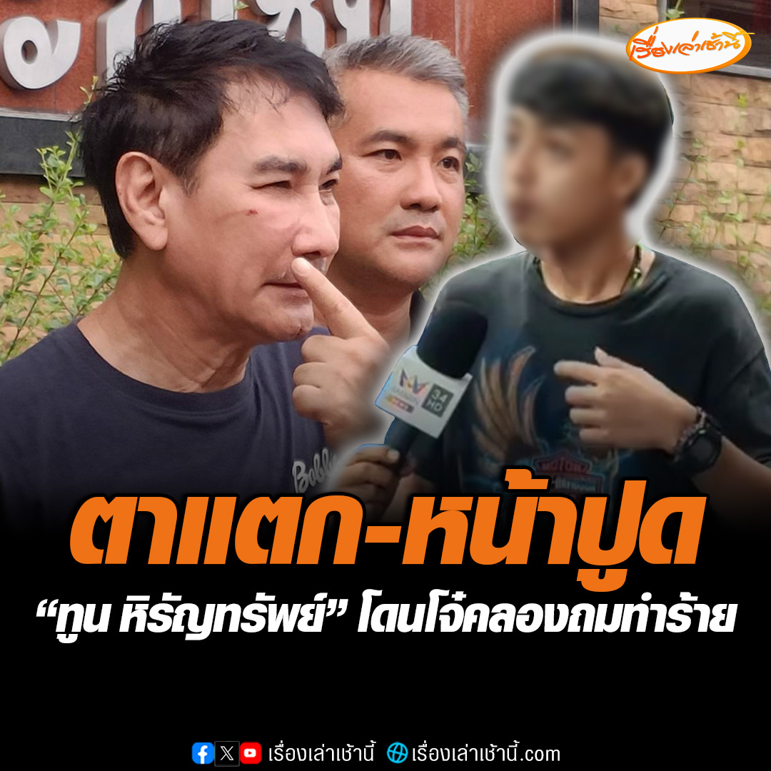 “ทูน หิรัญทรัพย์” นักแสดงชื่อดัง ถูกขาใหญ่ย่านคลองถมทำร้ายร่างกาย ตาแตก หน้าบวมปูด เหลือดไหลท่วม แจ้งความ สน.พลับพลาไชย 1 เนื่องจากมีปากเสียงกัน เรื่องซื้อของ #เรื่องเล่าเช้านี้ #ข่าวช่อง3 #ข่าวอาชญากรรม