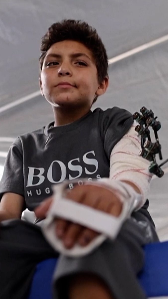 Adam al-Najjar, an 11-year-old Palestinian boy, has been evacuated to Italy for treatment after surviving an Israeli strike that killed his nine siblings and father. His mother was working at a hospital in Gaza when missiles struck their home.