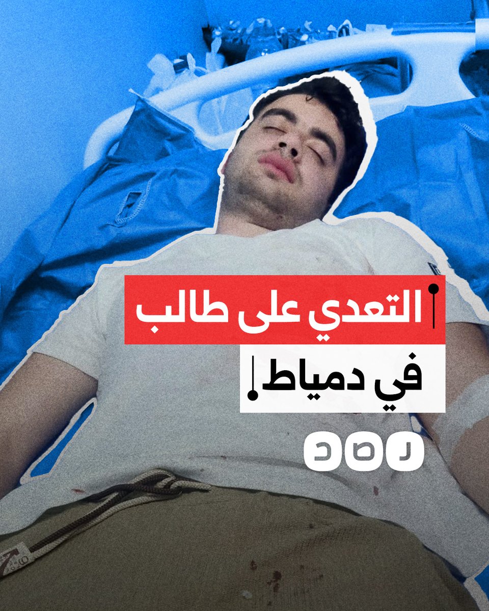 طعنوه لدخوله دورة المياه في المقهى دون طلب مشروبات.. استغاثة أم لإنقاذ نجلها بعد اعتداء عمال المقهى عليه في دمياط