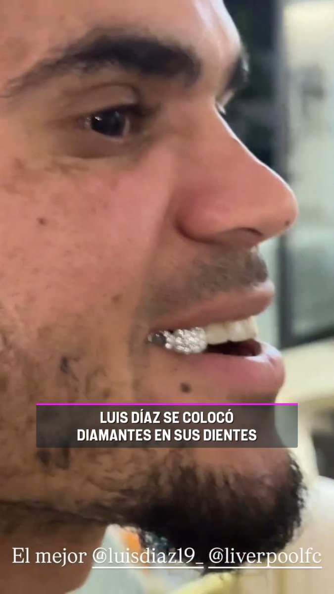 Lucho Díaz se puso DIAMANTES en su dentadura para su casamiento 💎🦷 🎥 sonrisaitaliana