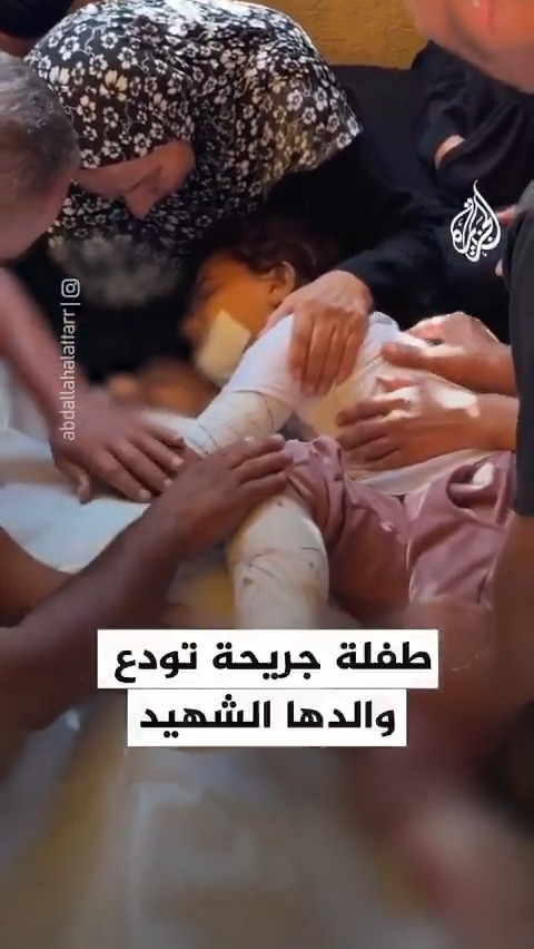 "إذا سامعني رد عليّ".. الطفلة الجريحة لونا رصرص تودع والدها الذي استشهد في قصف إسرائيلي استهدف خيمتهم في مواصي خان يونس بقطاع #غزة