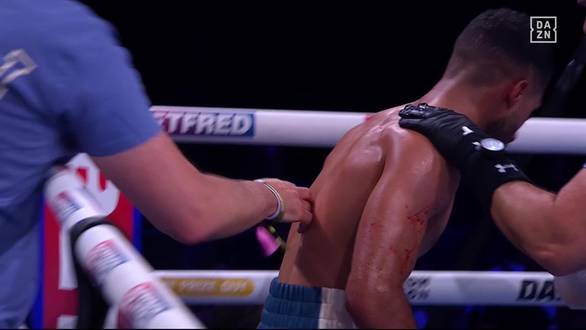 Scorecards through three 👀 #YafaiRodriguez | Live NOW on DAZN