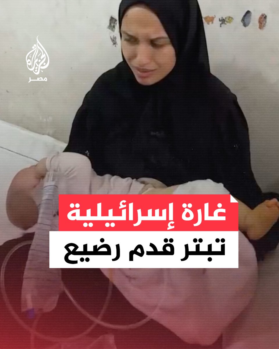 غارة إسرائيلية استهدفت عائلة الطفل الرضيع هاني الذي لم يتجاوز عمره الأربعة أشهر مما أدى إلى بتر قدمه الصغيرة