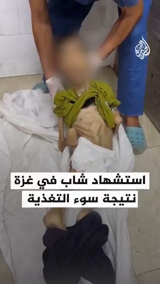 استشهاد الشاب أيوب أبو الحصين في خانيونس جنوب قطاع #غزة نتيجة سوء التغذية والمجاعة بسبب إغلاق المعابر ومنع إدخال المساعدات للقطاع #حرب_غزة