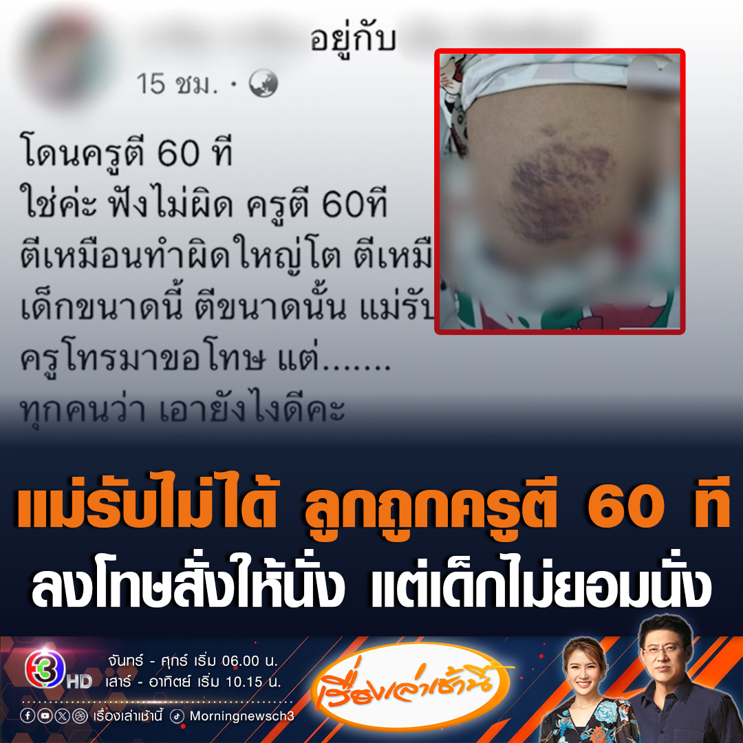 #เรื่องเล่าเช้านี้ แม่รับไม่ได้ ลูกถูกครูผู้ชายตี 60 ที ลงโทษเหตุสั่งให้เด็กนั่ง แต่เด็กเล่นกันอยู่ ไม่ยอมนั่ง ครูโทรมาขอโทษแล้ว พรุ่งนี้แม่เตรียมเข้าพบ ผอ. ยื่นเรื่องเอาผิดกับครูที่ก่อเหตุ #ข่าวช่อง3 #ครูตี #ครูตีนักเรียน #ลูกถูกตี #ครูลงโทษ