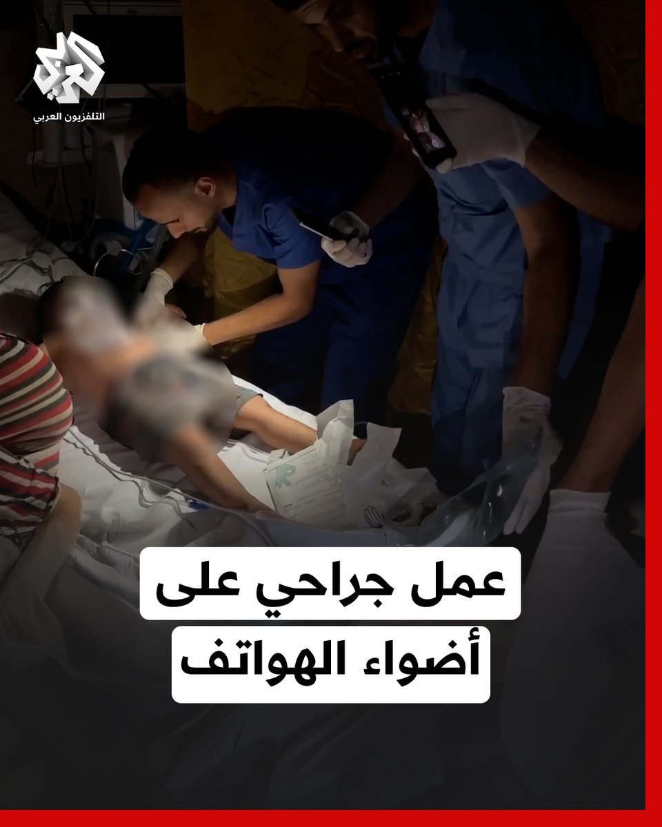 عاجل عمليات جراحية للأطفال على ضوء الهاتف بعد انقطاع التيار الكهربائي بشكل كامل الوضع صعب ، الصمت كارثة كبيرة