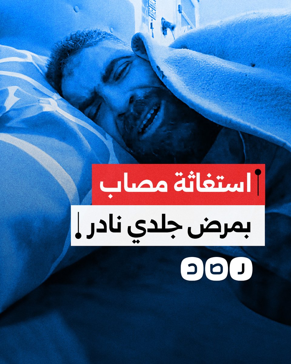 استغاثة مواطن مصاب بمرض جلدي نادر في محافظة القاهرة دون استجابة من المسؤولين