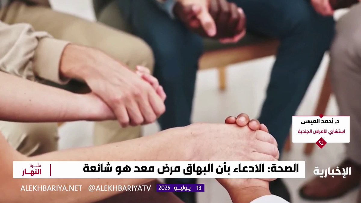 استشاري الأمراض الجلدية "د.أحمد العيسى": توجد ذاكرة في جسم مريض "البهاق" تعيد المرض بعد علاجه، وهناك علاج قادم يمنع عودة المرض.