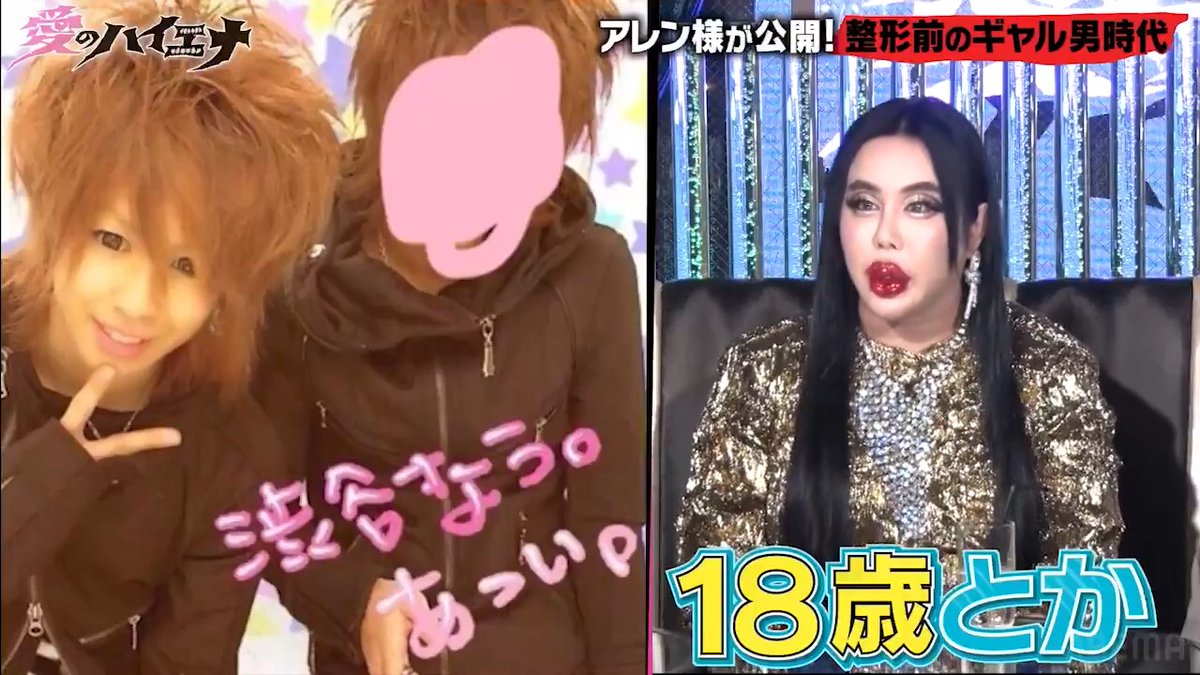 アレン様、ギャル男時代の写真公開!? 整形に1億円かけたアレン様 ギャル男時代の貴重な写真を公開！ さらに芸人で相手にしたい人も告白!? 『愛のハイエナ』シーズン4 ABEMAで配信中🔥