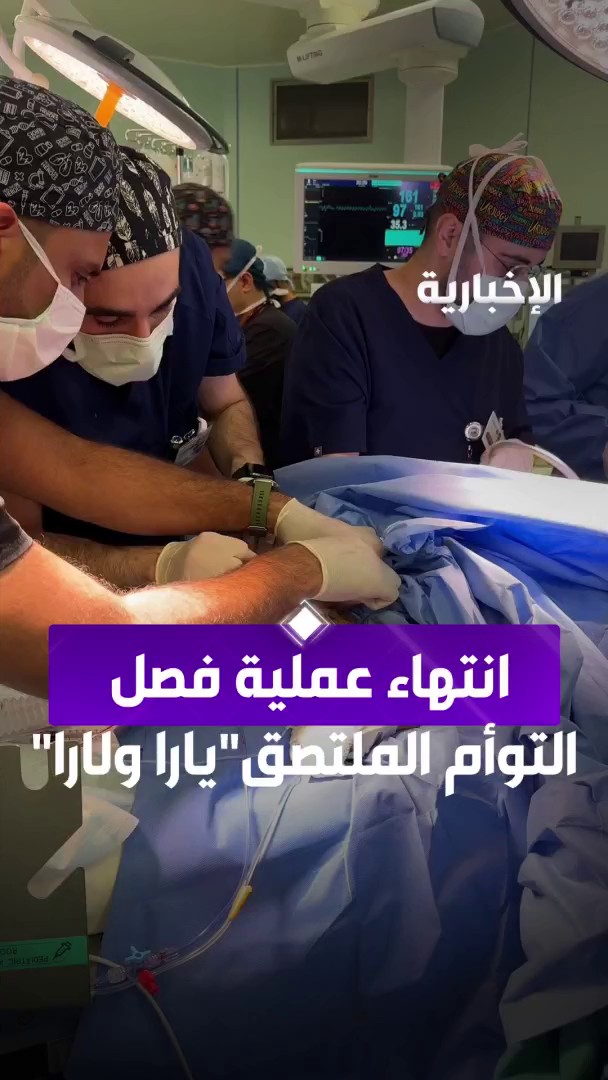 انتهاء عملية فصل التوأم الملتصق "يارا ولارا" عبر مراسل #الإخبارية سليمان الجبر
