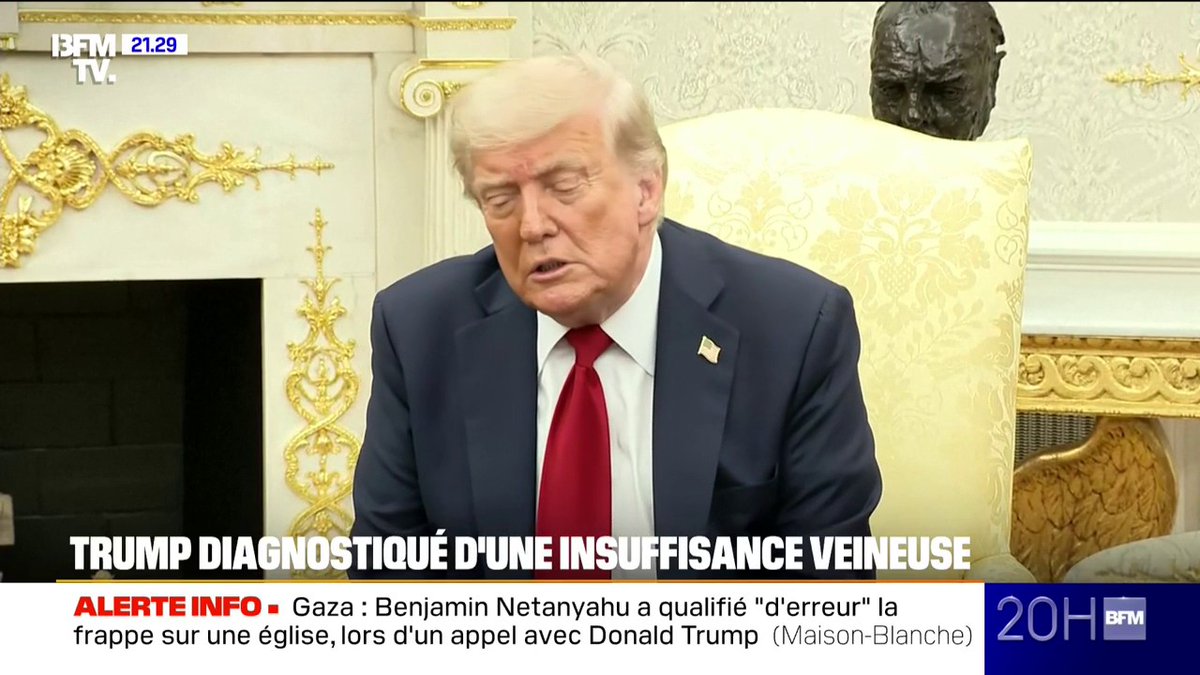 Donald Trump diagnostiqué d'une insuffisance veineuse chronique