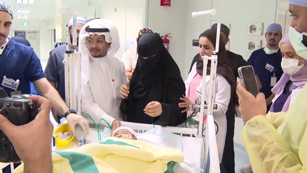 في مشهد مؤثر: والدا الطفلتين يارا ولارا يلتقيان بهما بعد نجاح العملية 🥺❤️