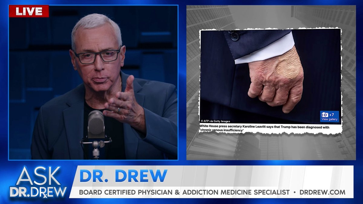 Before everybody gets anxious over President Trump's diagnosis of chronic venous insufficiency, let me explain what CVI is and why there's little reason to worry. As his physician wrote today: "President Trump remains in excellent health” with no evidence of arterial disease.
