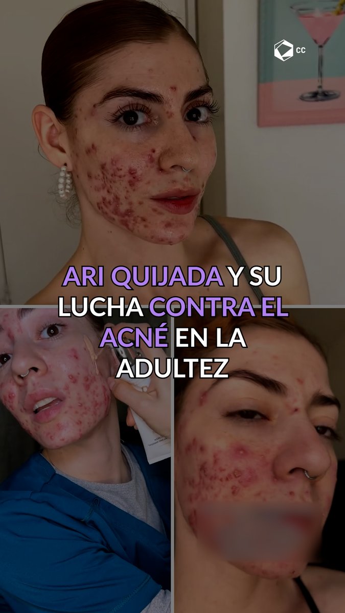 La historia de Ari es un recordatorio de que aceptarse es el mayor acto de amor propio. 💖