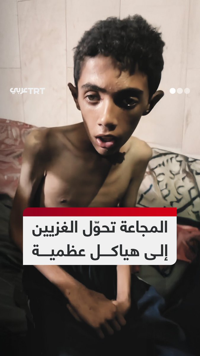 "الناس صاروا هياكل عظمية".. مشاهد مؤلمة تُظهِر أطفالاً في غزة برزت عظامهم جرّاء المجاعة التي يفرضها جيش الاحتلال الإسرائيلي على القطاع #تفاعل ليصل إليك كل جديد