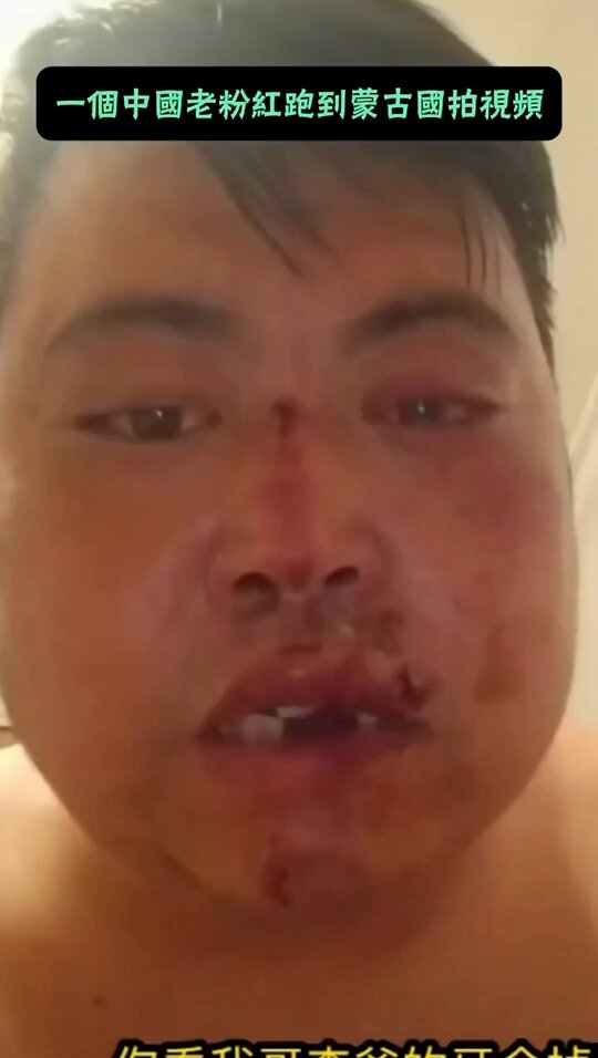 太酸爽了，🇨🇳小粉红跑到蒙古国举五星红旗🇨🇳拍视频，宣传蒙古是中国的一部分，被打掉7️⃣颗牙齿🦷～～