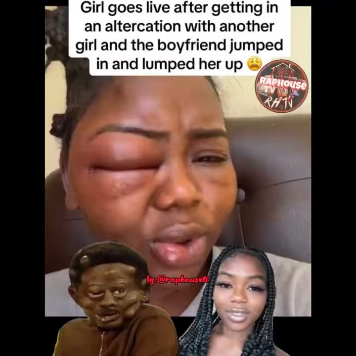 Girl goes live after getting in an altercation with another girl and the boyfriend jumped in and lumped her up.