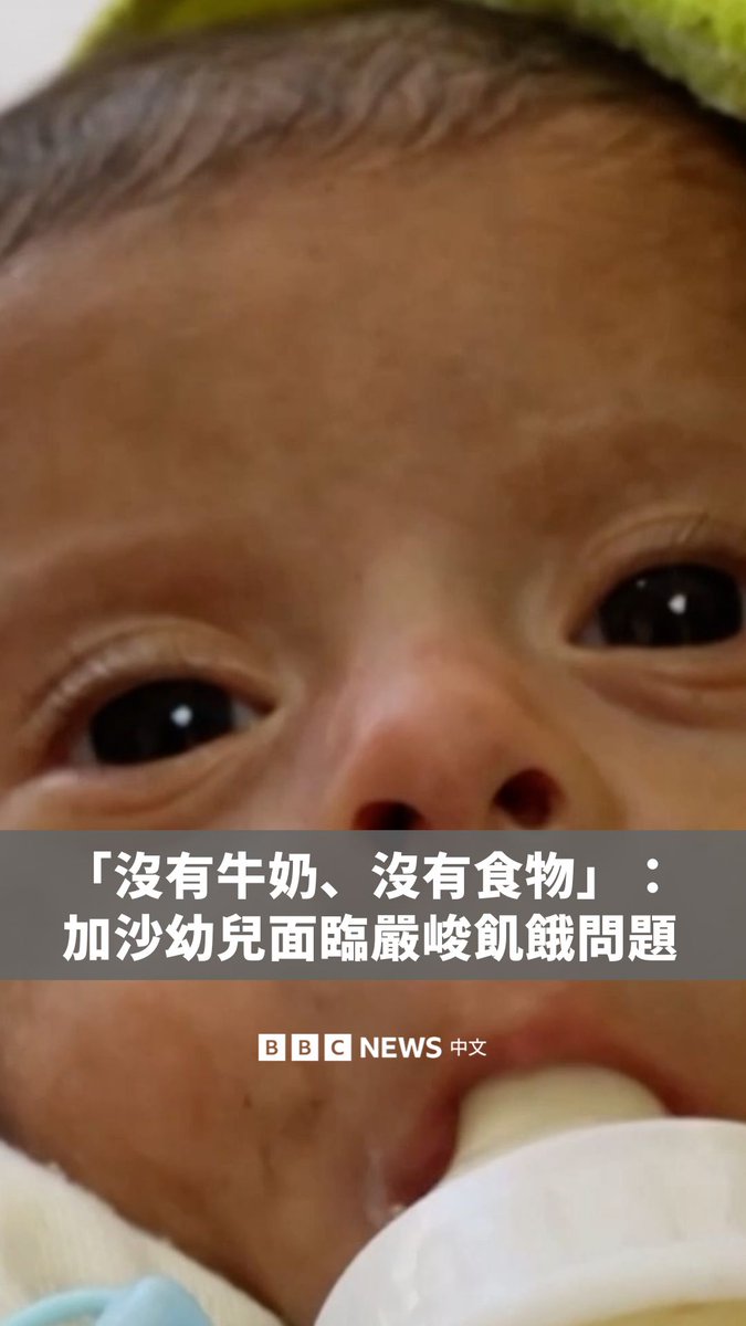 加沙地区的医疗单位指出,当地在短短三天内已有21名儿童因营养不良与饥饿死亡。一间位于加沙的医院表示,营养不良儿童病患的人数正急剧上升。 多位母亲反映,她们自身营养不足,无法哺乳,奶粉供应也极度短缺,部分儿童只能依靠静脉注射液维持生命。对此,以色列军方的援助协调机构表示,过去几周已有约2,000吨婴儿食品经由边境运送进入加沙。