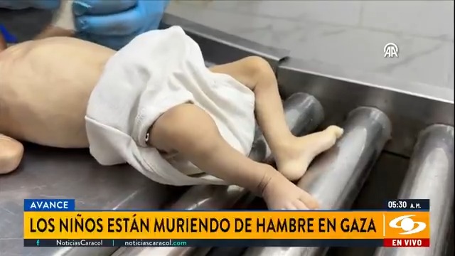 En Gaza 21 niños murieron de hambre en los últimos tres días, de acuerdo con reportes que han entregado los hospitales en Palestina. Más en