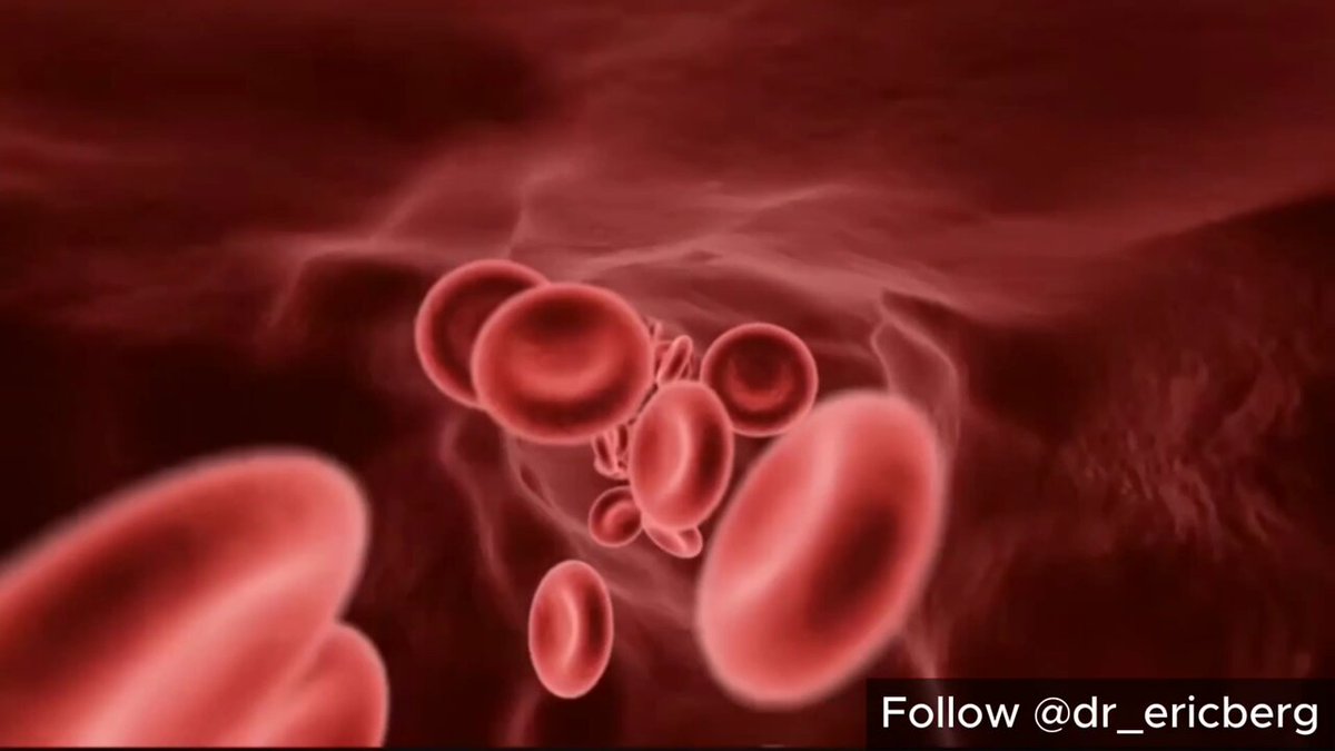 Imagine lymph as your body's garbage truck. It collects cellular waste from every tissue through a network 3x larger than your blood vessels. But unlike blood, lymph has no heart to pump it. It only moves when YOU move it.