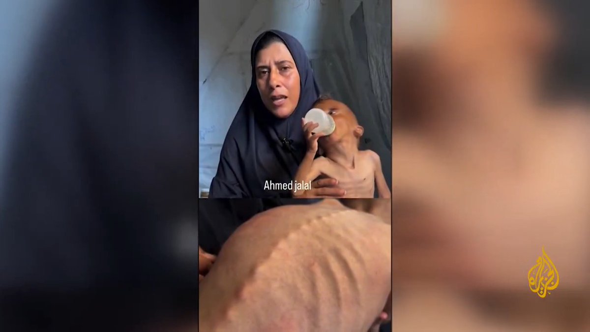 لم يتجاوز العامين ويصارع الموت جوعا.. محمد المطوق واحد من مليون طفل في #غزة تقول الأمم المتحدة إنهم يعانون سوء التغذية ويهددُهم الموت في القطاع، هناك حيث غابت ملامح الطفولة وتبدلت بوجوه شاحبة وأجساد هزيلة وعيون غائرة #الأخبار #حرب_غزة