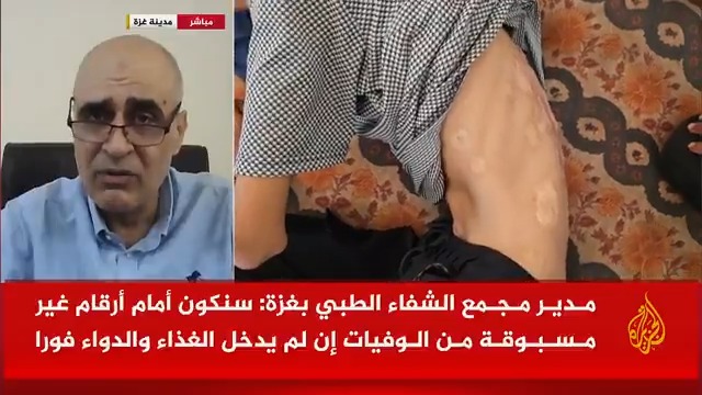رئيس شبكة المنظمات الأهلية الفلسطينية في القطاع أمجد الشوا: الأمور تزداد سوءا على كافة المستويات والجوع يشتد في قطاع غزة، ووفق التقارير هناك 1 من كل 5 أطفال يعاني من سوء تغذية حاد بما يهدد حياته، والاحتلال ما زال يمعن في منع دخول المساعدات #حرب_غزة #الأخبار