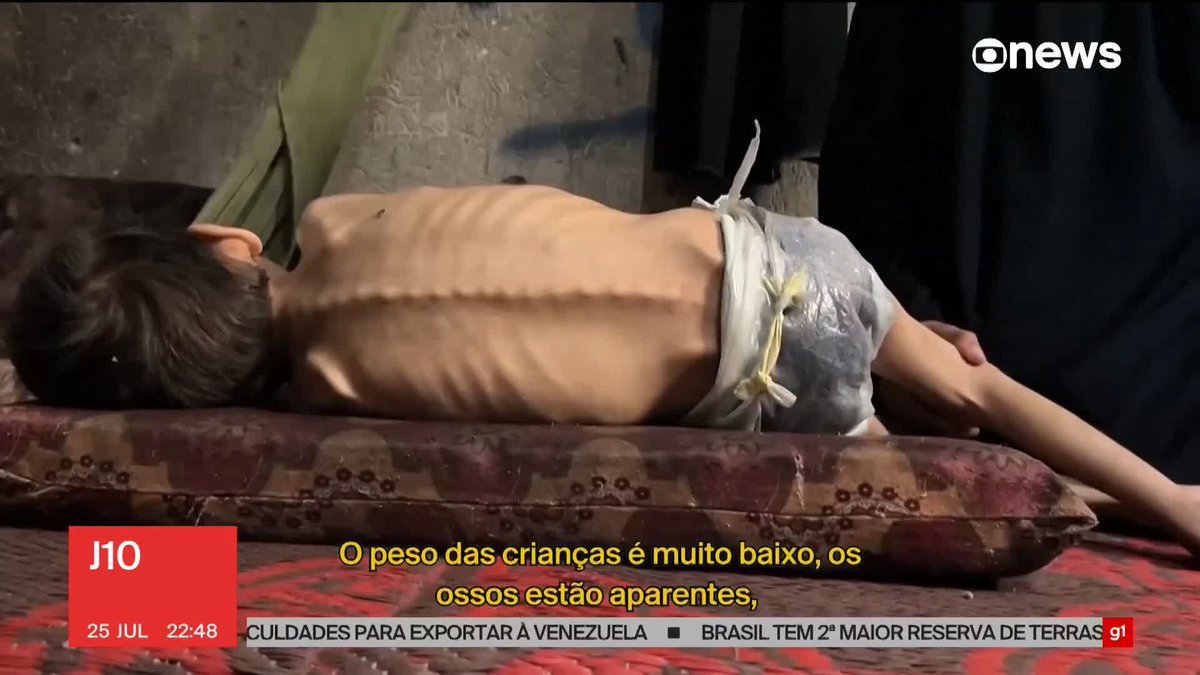 ONU: 1 em cada 3 pessoas passa dias sem comer em Gaza. Segundo Médicos Sem Fronteiras, desnutrição infantil triplicou em 2 semanas. Israel vai permitir ajuda humanitária aérea em Gaza. ➡️Assista ao #J10 na #GloboNews: