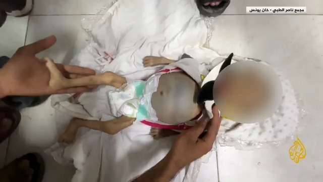 عمرها 6 أشهر.. وفاة الرضيعة الفلسطينية زينب أحمد أبو حليب من سكان مدينة خان يونس بسبب التجويع وسوء التغذية #الأخبار #حرب_غزة