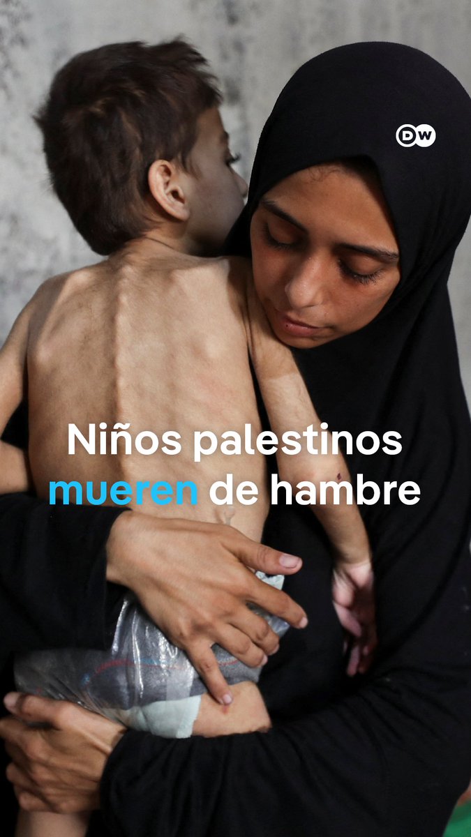 El hambre se ensaña con los niños en Gaza Crece la presión internacional sobre Israel para que desbloquee la entrada de alimentos en la Franja de Gaza. Médicos Sin Fronteras informa que 1 de cada 4 niños de entre seis meses y cinco años sufre algún grado de desnutrición, y que los casos graves se han triplicado en solo dos semanas.