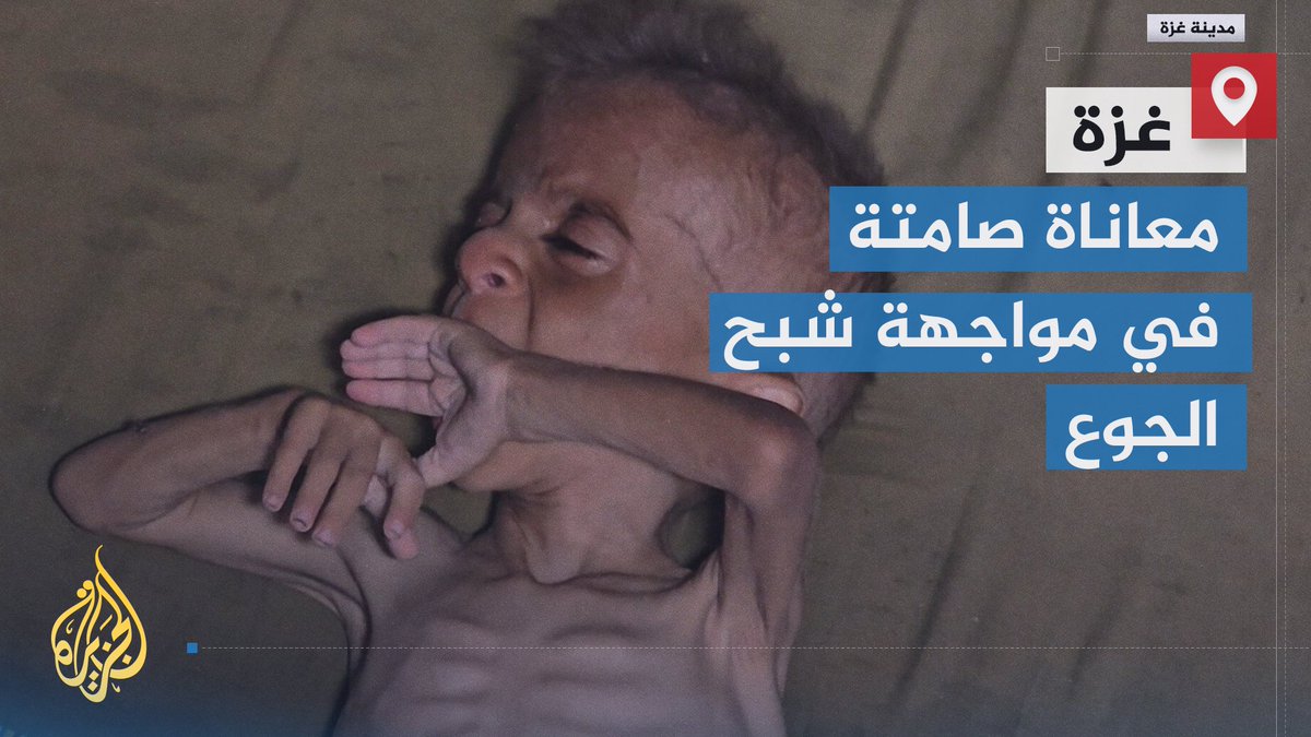تحولت أجسادهم إلى ما يشبه الهياكل العظمية.. الجوع يفتك بالأطفال في قطاع #غزة جراء انعدام الدواء والمواد الغذائية الأساسية وفي مقدمتها الحليب | تقرير: أنس الشريف #حرب_غزة #الأخبار