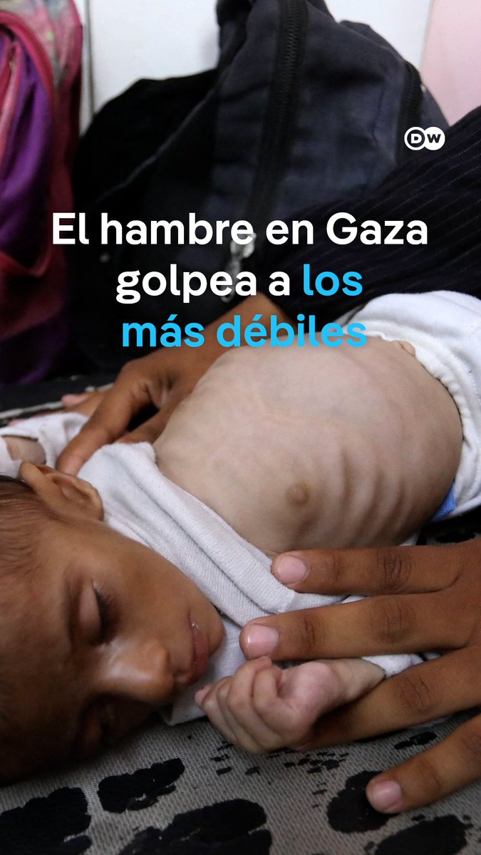 OMS: Gaza sufre una "hambruna masiva generada por el hombre" El bloqueo de la ayuda humanitaria en Gaza, que llega a cuentagota tras el anuncio israelí de permitir el ingreso de más camiones con víveres, hace que cientos de miles de personas estén en peligro de inanición. La infancia es la mayor perjudicada.
