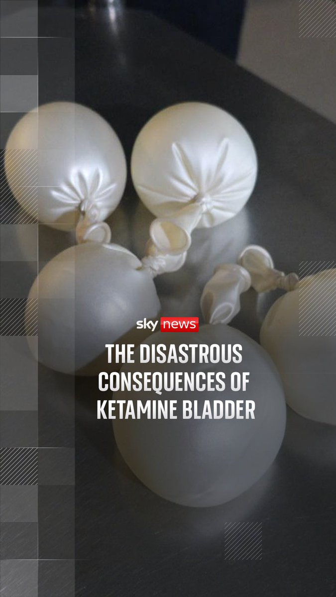 Health workers on the frontline of drug recovery have told Sky News that the UK faces a tidal wave of problems if more isn't done to stop people taking ketamine. Click here to read Shingi Mararike full report ➡️