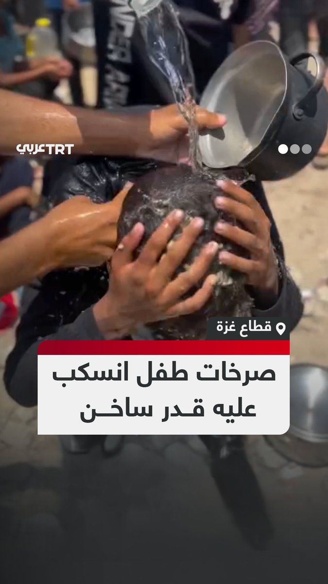 "ماء! ماء!".. طفل فلسطيني يصرخ من شدة ألم الحريق بعد أن انسكب عليه قدر ساخن في أثناء محاولته الحصول على طعام من إحدى التكايا في ظل الحصار والتجويع المستمر الذي يفرضه الاحتلال على قطاع غزة. #تفاعل ليصل إليك كل جديد