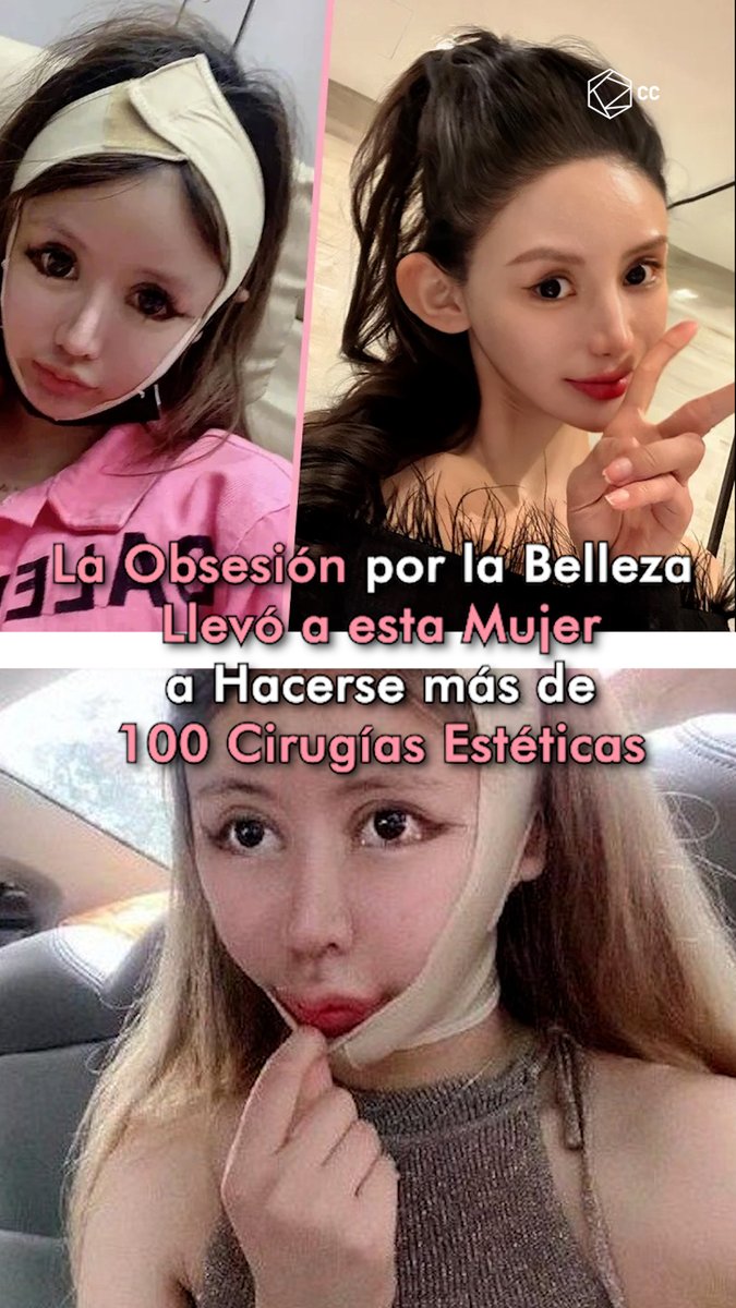 La primera cirugía de Zhou fue autorizada por su madre a los 13 años, pero ahora sus padres no saben cómo hacerla parar.😰