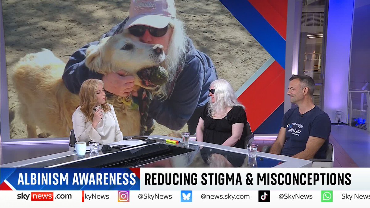 "It is still one of those conditions that people still think they can make fun of" Chair of Albinism Fellowship UK and Ireland, Kristina Venning Rose, tells Sarah-Jane Mee why she wants to raise awareness for the condition and what it was like growing up with Albinism ⬇️