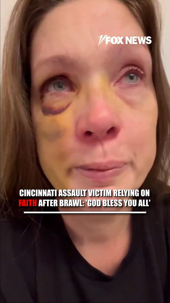 WATCH: The beating victim knocked out in a viral downtown Cincinnati brawl is speaking out for the first time in a tearful video.