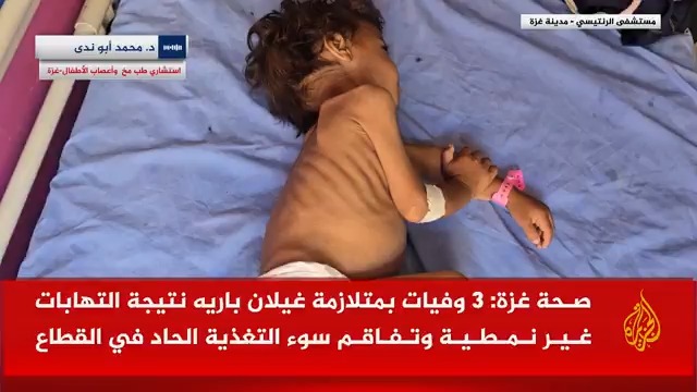 استشاري طب مخ وأعصاب الأطفال محمد أبو ندى: متلازمة "غيلان باريه" كانت نادرة جدا في القطاع ما قبل #حرب_غزة، وتؤدي بالنهاية إلى شلل كامل لا يستطيع الطفل التنفس من نفسه، ولا بد من التنفس الصناعي ما لم يعطى العلاج في وقته #الاخبار