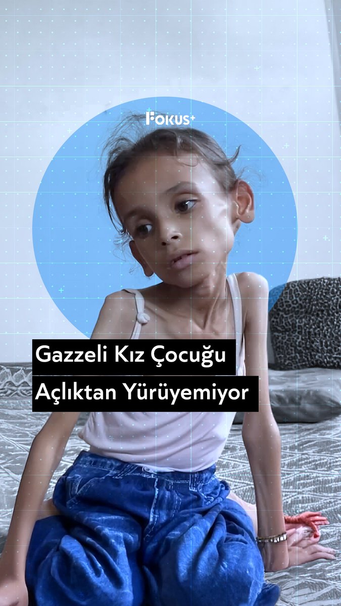 ➕️ Gazzeli Meryem yürüyemez hale geldi ▪️ İsrail ablukasının yol açtığı ağır beslenme yetersizliği nedeniyle 9 yaşındaki Gazzeli Meryem Davas yürüme yetisini kaybetti.
