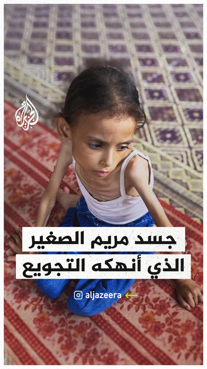 مريم.. طفلة من غزة أنهكها التجويع وبات وزن جسدها النحيل لا يتجاوز 10 كلغ #حرب_غزة