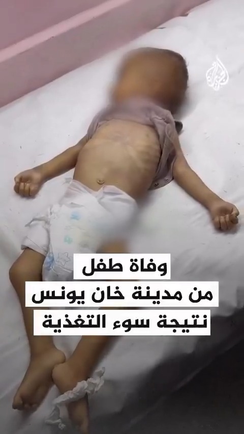 محمد زكريا عصفور.. طفل لم يتجاوز عمره 16 شهرا توفي بسبب سوء التغذية وعدم توفر العلاج في قطاع غزة #حرب_غزة