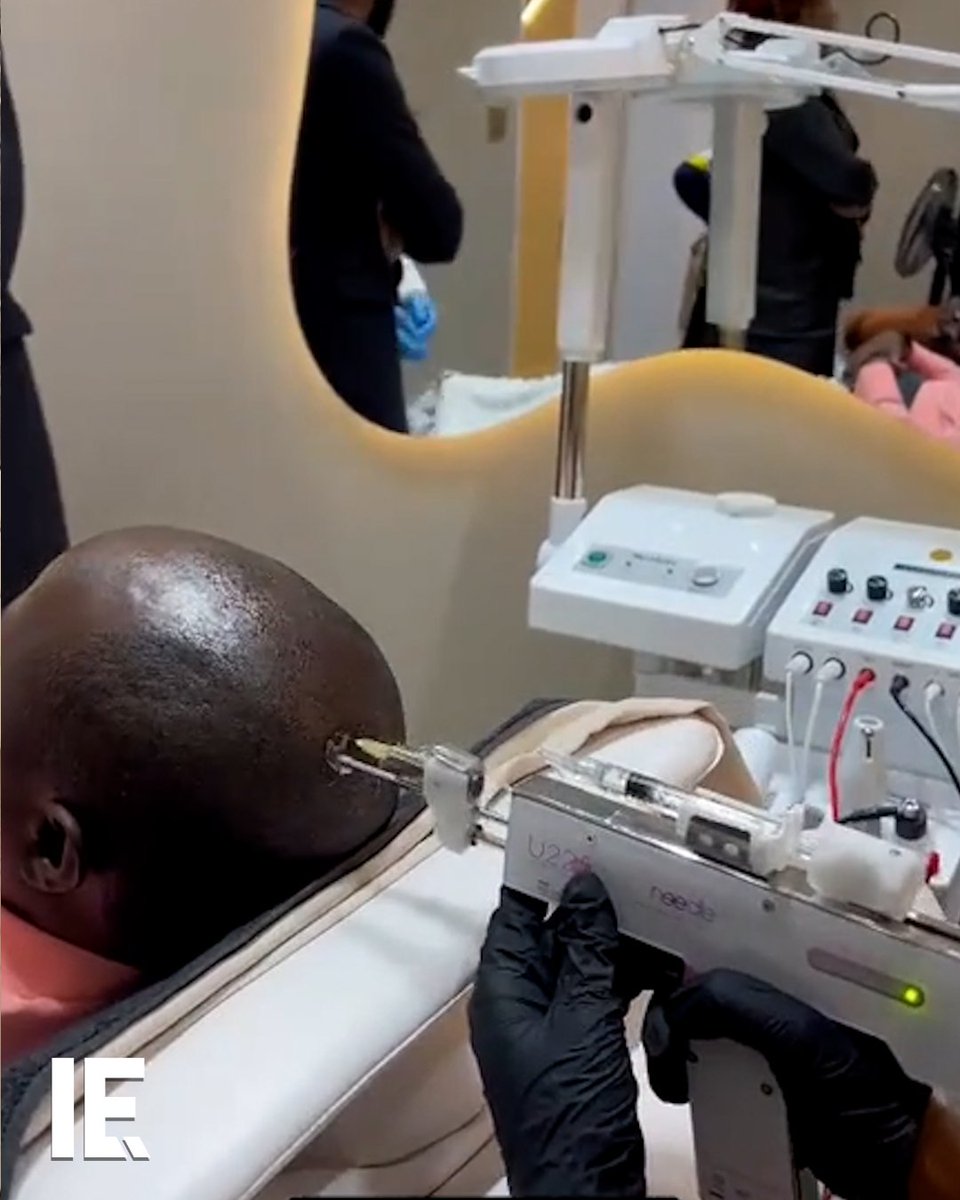 Looks like polynucleotide implants can save even a fully bald head. ๐ฅ makenamercy / TT