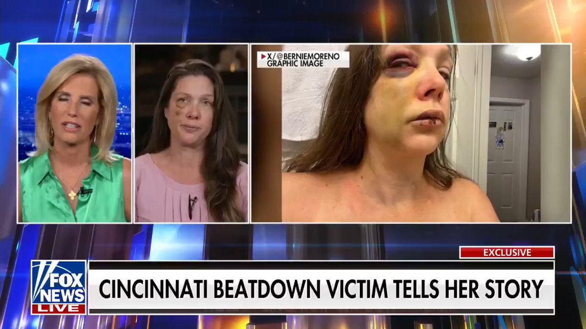 "There were some comments about 'White people shouldn't be out here'... Definitely it was a little scary, and then when they started circling... It was just an attack that should've never happened." Holly, victim in the viral Cincinnati attack, recalls brutal beatdown in exclusive Laura Ingraham interview